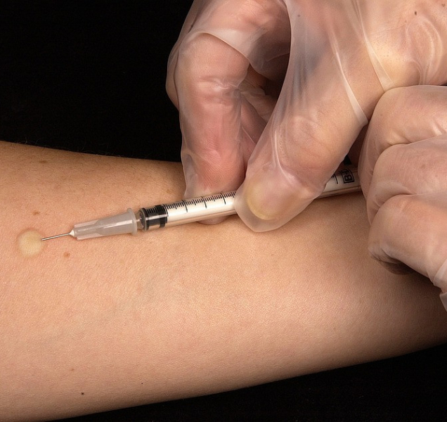 Vylhaná zpráva o tuberkuloze k nám možná přišla ze zahraničí